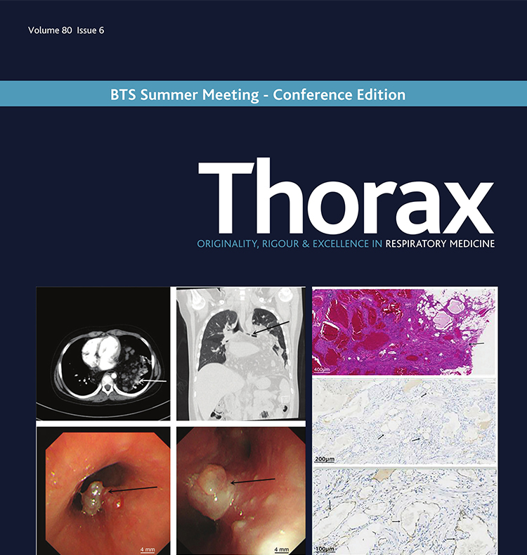Thorax international journal